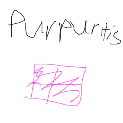 Purpuritis